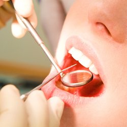 #31329 Servidores do campus Cidade Alta já podem fazer Exame Periódico Odontológico